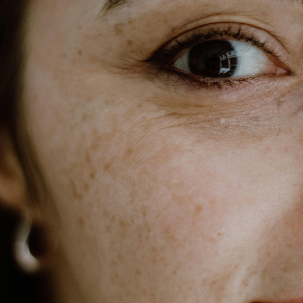 Peau-visage-femme